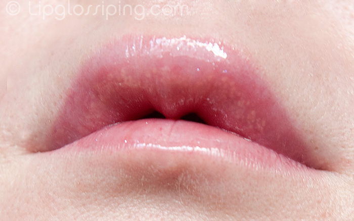 Sore, swollen lips that won't heal? - I cannot get a ...